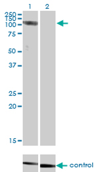 CLCN2 monoclonal antibody (M01), clone 3E1