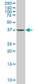 CDX2 monoclonal antibody (M01), clone 1C7