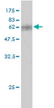 CDX2 monoclonal antibody (M01), clone 1C7