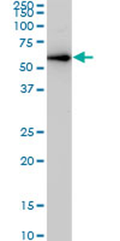 CDK8 monoclonal antibody (M03), clone 5H4