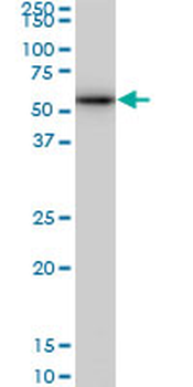 CDK8 monoclonal antibody (M03), clone 5H4