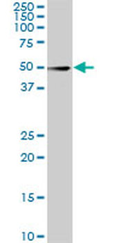 CDK8 monoclonal antibody (M03), clone 5H4