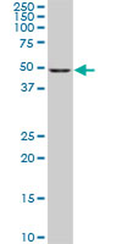 CDK8 monoclonal antibody (M03), clone 5H4