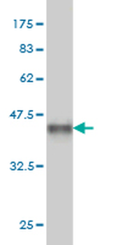 CDK8 monoclonal antibody (M03), clone 5H4