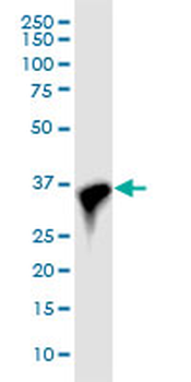 CDK6 monoclonal antibody (M01J), clone 8H4