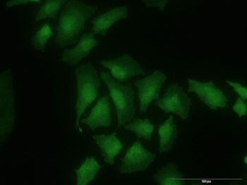 CDK6 monoclonal antibody (M01J), clone 8H4