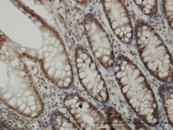 CDK6 monoclonal antibody (M01J), clone 8H4