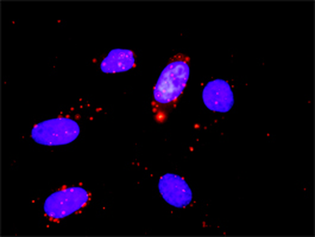 CDK6 monoclonal antibody (M01J), clone 8H4