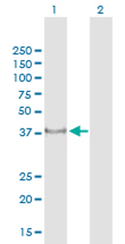 CDK6 monoclonal antibody (M01J), clone 8H4