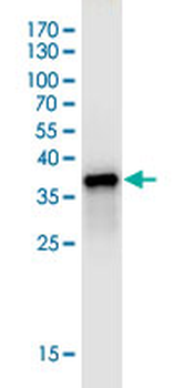 CDK6 monoclonal antibody (M01J), clone 8H4