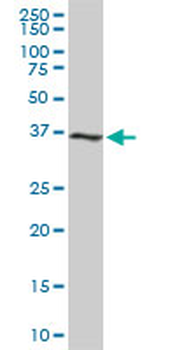 CDK6 monoclonal antibody (M01), clone 8H4