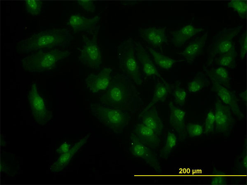 CDK6 monoclonal antibody (M01), clone 8H4