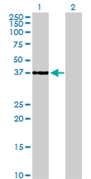 CDK6 monoclonal antibody (M01), clone 8H4