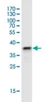 CDK6 monoclonal antibody (M01), clone 8H4