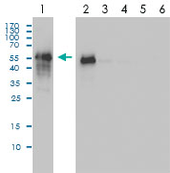 CDC2 monoclonal antibody (M01), clone 1A4-1A9