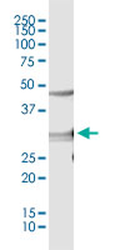 CDC2 monoclonal antibody (M01), clone 1A4-1A9