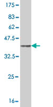 ENTPD6 monoclonal antibody (M03), clone 2D10