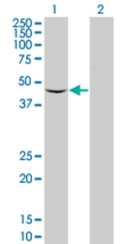 SCARB2 polyclonal antibody (A01)