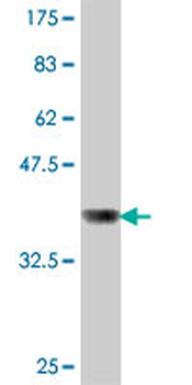 SCARB2 polyclonal antibody (A01)