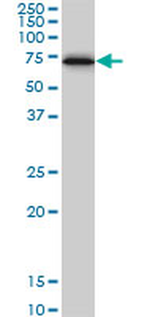 CBS monoclonal antibody (M01), clone 3E1