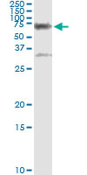 CBS monoclonal antibody (M01), clone 3E1