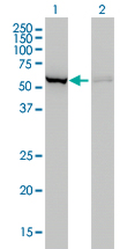 CBS monoclonal antibody (M01), clone 3E1