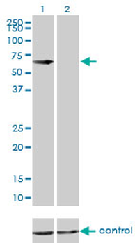 CBS monoclonal antibody (M01), clone 3E1