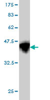 CBS monoclonal antibody (M01), clone 3E1