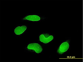 RUNX1T1 monoclonal antibody (M01), clone 5A12