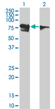 RUNX1T1 monoclonal antibody (M01), clone 5A12