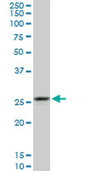 CAPNS1 monoclonal antibody (M01), clone 3C4