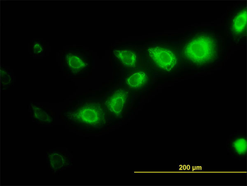 CAPNS1 monoclonal antibody (M01), clone 3C4