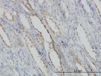 CAPNS1 monoclonal antibody (M01), clone 3C4