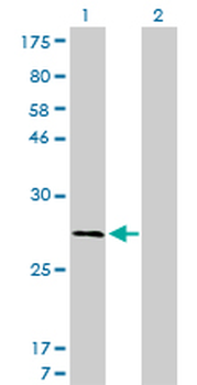 CAPNS1 monoclonal antibody (M01), clone 3C4