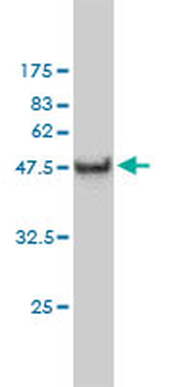 CA3 monoclonal antibody (M02), clone 4A12-1A3