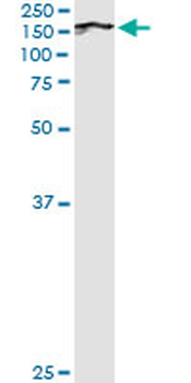 BUB1 monoclonal antibody (M02), clone 2F9