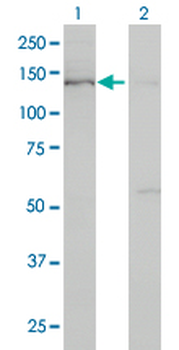 BUB1 monoclonal antibody (M02), clone 2F9