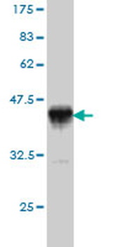 BUB1 monoclonal antibody (M02), clone 2F9