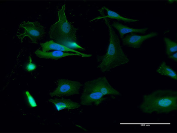 BUB1 purified MaxPab rabbit polyclonal antibody (D01P)