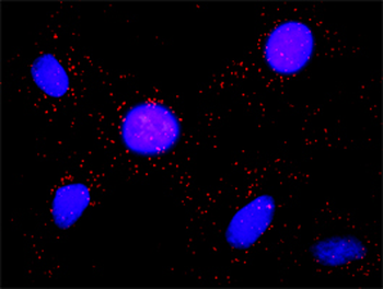 BUB1 purified MaxPab rabbit polyclonal antibody (D01P)