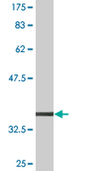 BMPR1B monoclonal antibody (M07), clone 2E2