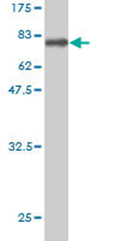 BMP7 monoclonal antibody (M03), clone S52