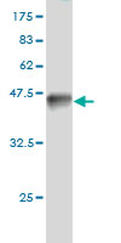 BAG1 monoclonal antibody (M02), clone 2D3