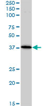 BAG1 monoclonal antibody (M02), clone 2D3