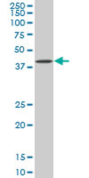 BAG1 monoclonal antibody (M02), clone 2D3