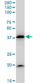 BAG1 monoclonal antibody (M02), clone 2D3