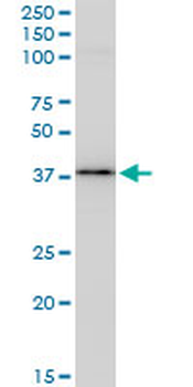 BAG1 monoclonal antibody (M02), clone 2D3