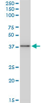 BAG1 monoclonal antibody (M02), clone 2D3