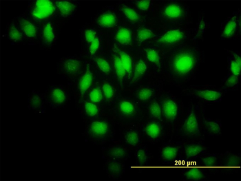 BAG1 monoclonal antibody (M02), clone 2D3