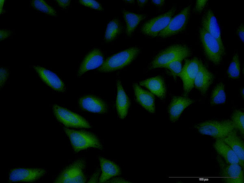 B2M monoclonal antibody (M01J), clone 3F9-2C2